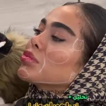 کلینیک زیبایی بلا