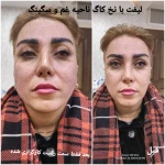 کلینیک زیبایی و لیزر مو گندم