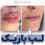 نمونه کار مرکز پوست ،مو و زیبایی دکتر فریبا محمدی