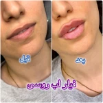 مرکز لیزر و زیبایی آرورا