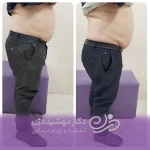 نمونه کار کلینیک تغذیه  رژیم درمانی دکتر مهشید دژن