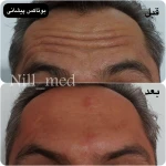 کلینیک پوست مو زیبایی و لیزر نیل