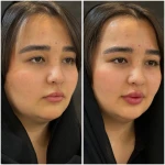 مطب زیبایی لیانارخ