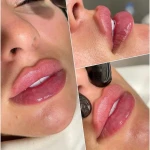 کلینیک پوست مو زیبایی و لیزر آیسل