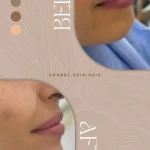 کلینیک زیبایی درناز (تخفیف ویژه لیزر)