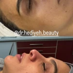کلینیک زیبایی فشیال دکتر هدیه دهقان پور