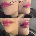 کلینیک زیبایی و لیزر مو گندم