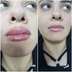 کلینیک زیبایی و لیزر مو گندم