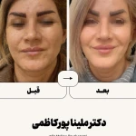 مطب  دکتر ملینا پورکاظمی