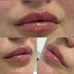 نمونه کار کلینیک پوست و مو و لیزر آتن