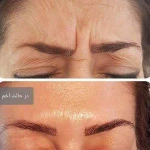 کلینیک زیبایی ریجینا