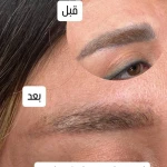 مرکز لیزر و کلینیک زیبایی سورا