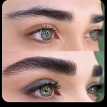 نمونه کار کلینیک زیبایی تهران بیوتی سنتر