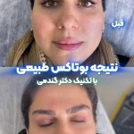 نمونه کار کلینیک زیبایی و لیزر دکتر میلاد گندمی