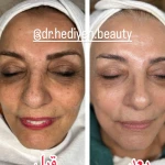کلینیک زیبایی فشیال دکتر هدیه دهقان پور