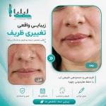 کلینیک لیزر و زیبایی لیلیا