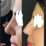 کلینیک زیبایی و مرکز لیزر موی زائد آریسا