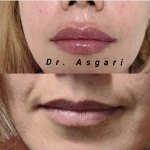 کلینیک زیبایی پوست و لیزر ایده آل