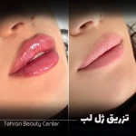 تصویر کلینیک زیبایی تهران بیوتی سنتر