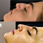 مرکز لیزر و زیبایی هانیسا