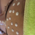 نمونه کار مرکزفوق تخصصی جراحی زیبایی دایموند(پوست)