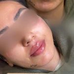 کلینیک زیبایی و مرکز لیزر و هایفو مرکز دلورا