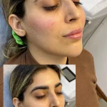 تصویر کلینیک زیبایی فریحا(پوست و مو)