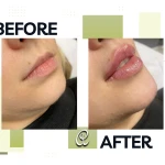 مرکز سلامت و زیبایی آمیس