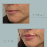 مركز ليزر و لاغري آيسان