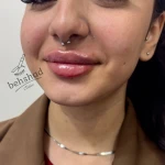 کلینیک تخصصی پوست و زیبایی بهشاد