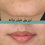  کلینیک پوست مو لیزر لاغری زیباریس
