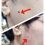 کلینیک لیزر و زیبایی مهرُنا