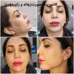 کلینیک زیبایی و لیزر مو گندم