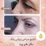 مرکزفوق تخصصی جراحی زیبایی دایموند(پوست)