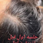 نمونه کار کلنیک زیبایی و لیزر نایس