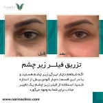 کلینیک تزریق بوتاکس و فیلر نارینا