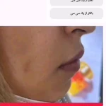 دکتر زیبایی بوتاکس دکتر شیرین امیر حسنی