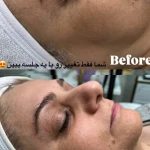 نمونه کار کلینیک زیبایی فشیال دکتر هدیه دهقان پور