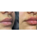 مرکز لیزر،پوست،مو و زیبایی سرو مهر