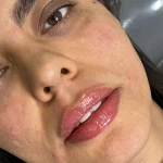 کلینیک زیبایی  و لاغری تخصصی میرای