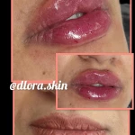 کلینیک زیبایی و مرکز لیزر و هایفو مرکز دلورا