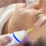 کلینیک  لیزر موهای زائد و زیبایی مهرنیا