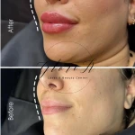 کلینیک زیبایی گلوریا