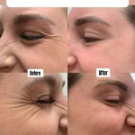 مرکز لیزر موهای زائد و پاکسازی پوست نوترسا