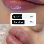 مرکز لیزر کلینیک زیبایی رزنیلای مرزداران