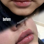 کلینیک لیزر و زیبایی مهرُنا