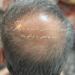 اسکالپ سر عارفه باقری