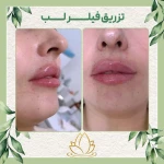 مرکز پوست ،مو و زیبایی رایا