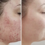 فیشال تخصصی و درمانی میسون