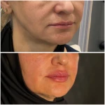 مطب زیبایی لیانارخ